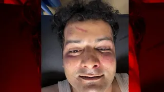 Delhi Protest : भीड़ ने मुझे भी घेर लिया, ACP विवेक भगत पर जानलेवा हमला